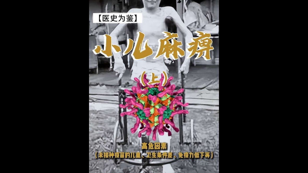 《小儿麻痹症（上）》它是人类20世纪最恐惧的“传染病”之一，它让全世界的父母都陷入恐慌，不敢让孩子去游泳池，不敢让孩子参加夏令营，甚至不敢让孩子出门玩耍。#科普 #中國醫 #涨知 #涨知识 #科普