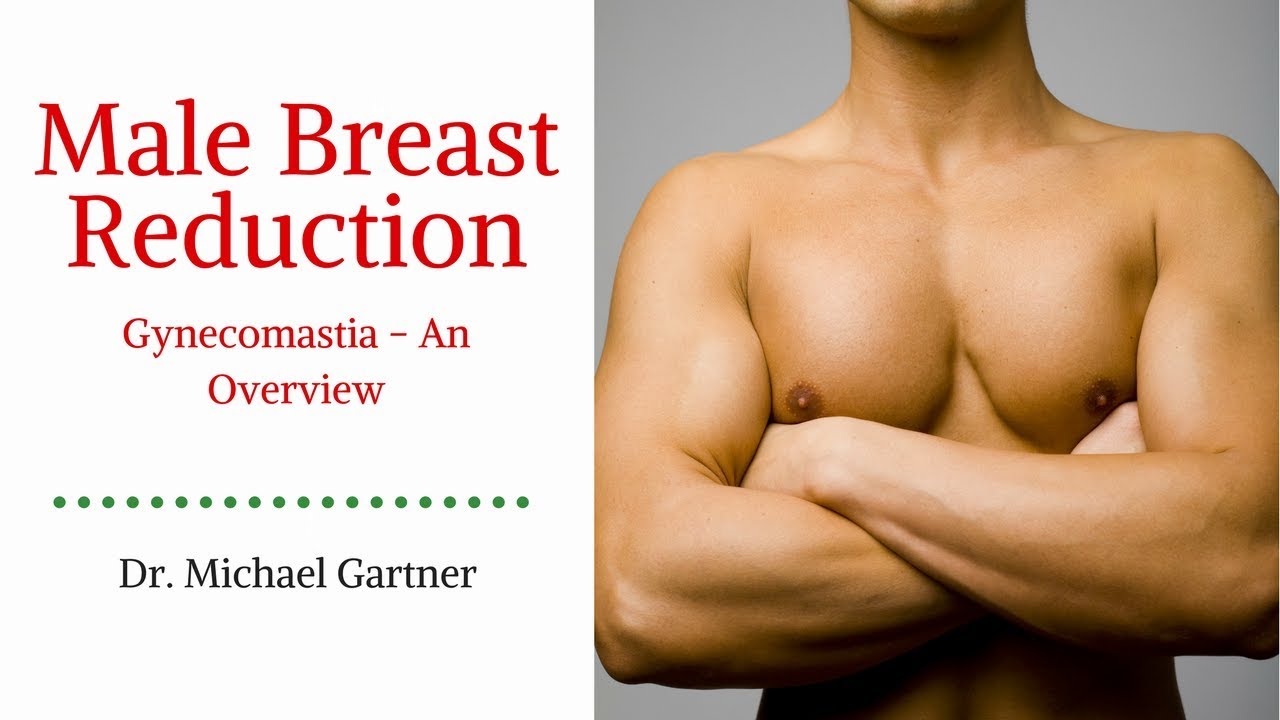Male Breast Reduction (Gynecomastia) | Dr. Michael Gartner