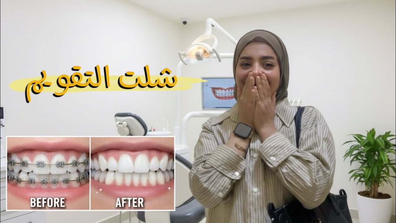 شلت التقويم ! النتيجه صدمه
