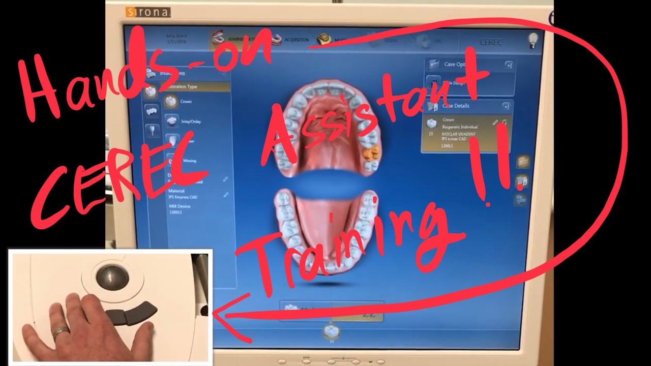CEREC Dental Assistant Training - hands on crown design - setup through positioning