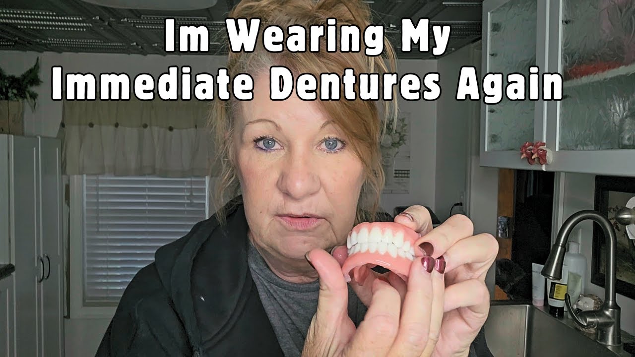 My Immediate Dentures VS Permanent Dentures (THIS IS AWFUL)