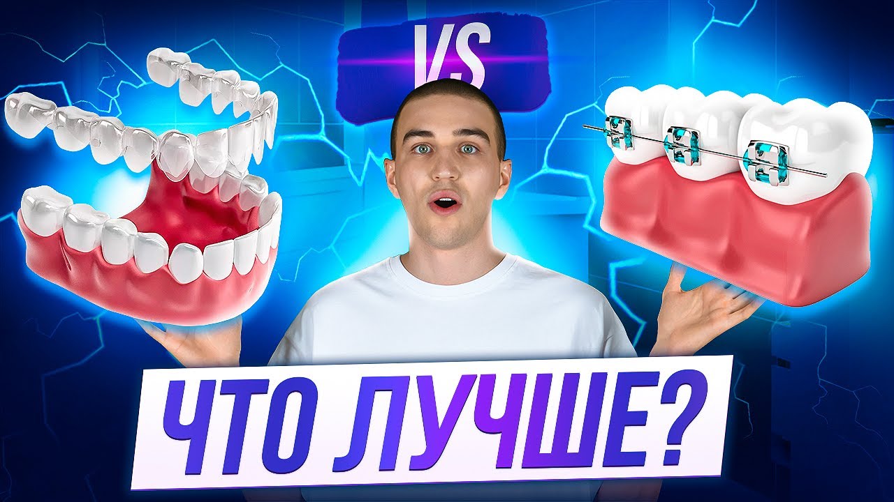 Элайнеры или Брекеты?! Как выбрать?