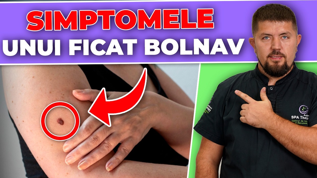 Aceste indicii îți spun că ficatul tău are nevoie de ajutor! 99% dintre oameni le ignoră...