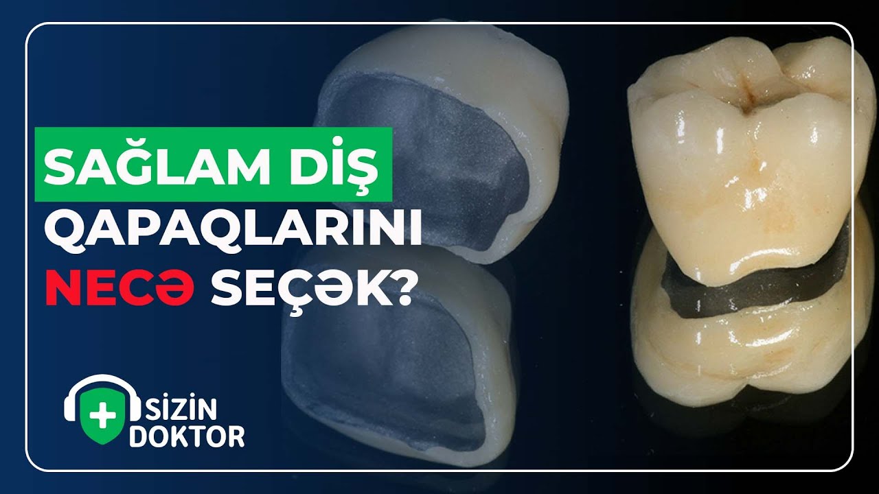 HANSI DİŞ QAPAQLARI UZUN MÜDDƏTLİDİR? - SİZİN DOKTOR - (07.09.2023)