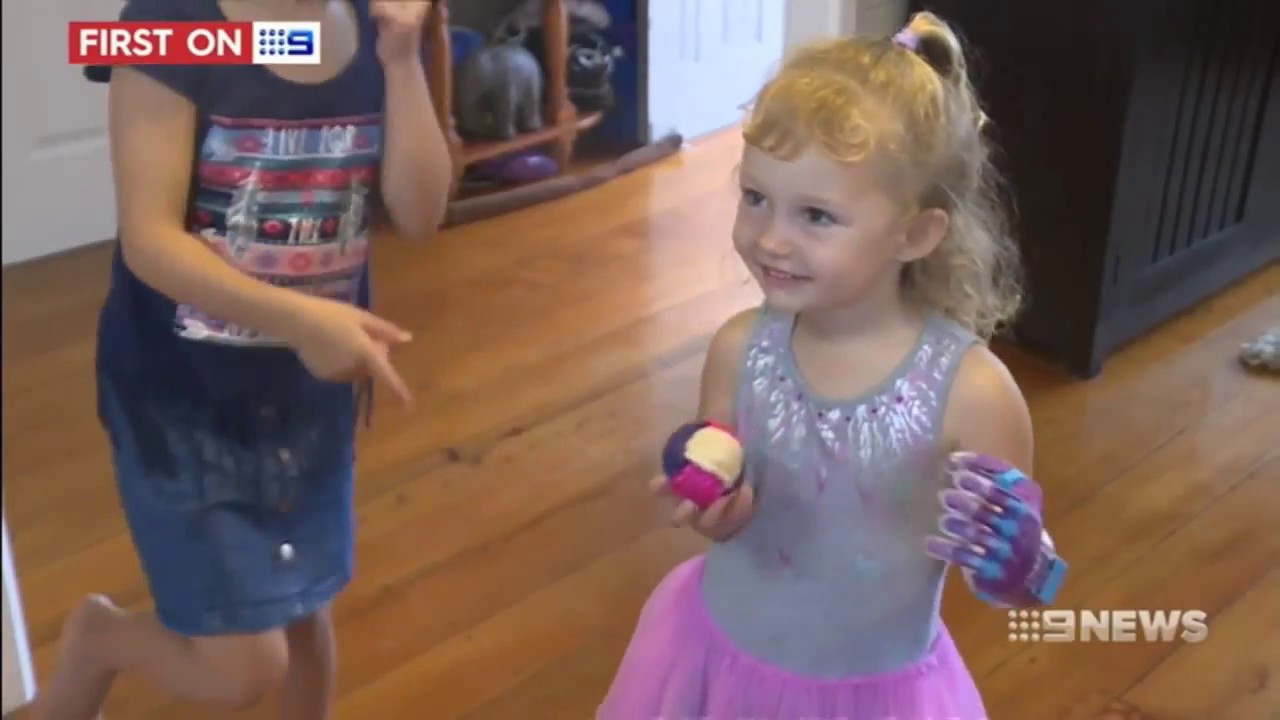 9 News Report- Mat Bowtell makes free 3D prosthetic hands