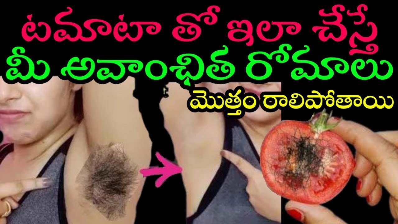 టమాటా తో ఇలా చేస్తే మీ అవాంఛిత రామాలు వెంటనే రాలిపోతాయి|ఒక్కసారి ట్రై చేసి చూడండి remove facial hair