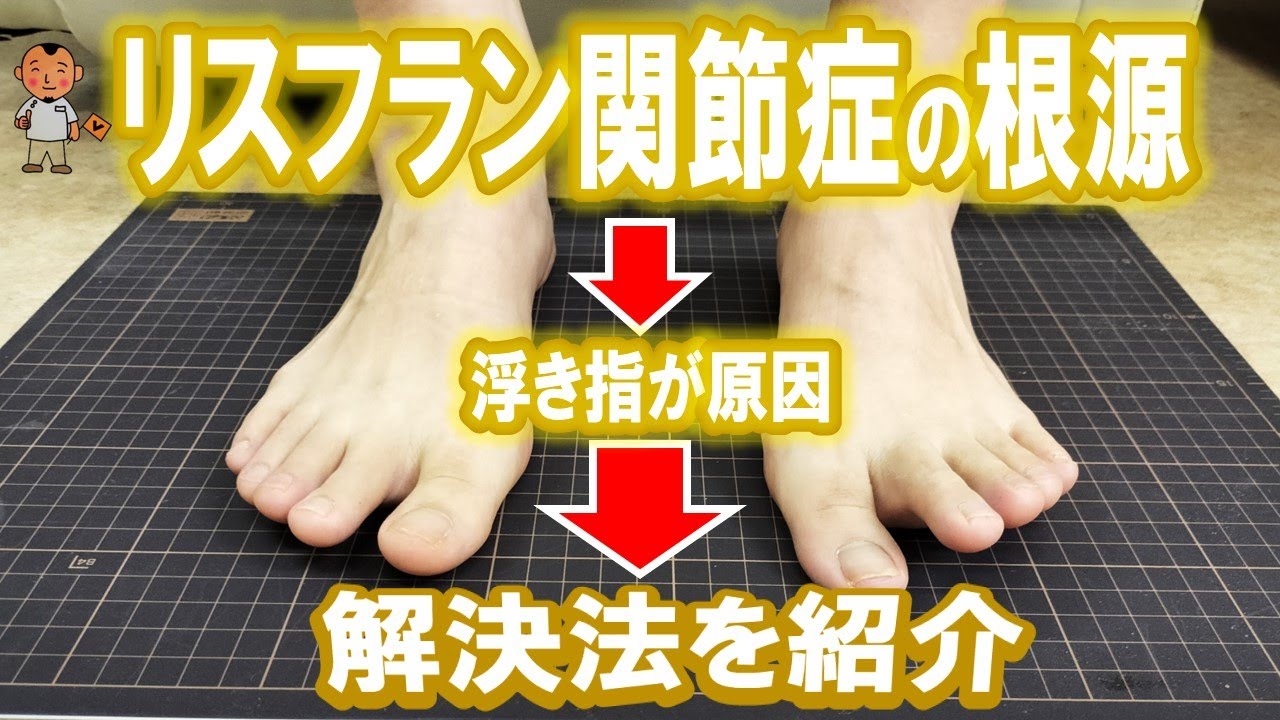 足の甲の痛み（リスフラン関節症）の根源は浮き指改善が重要