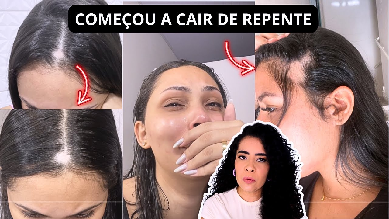 TIKT0KES ESTÃO PERDENDO O CABELO ! O QUE ACONTECEU ?