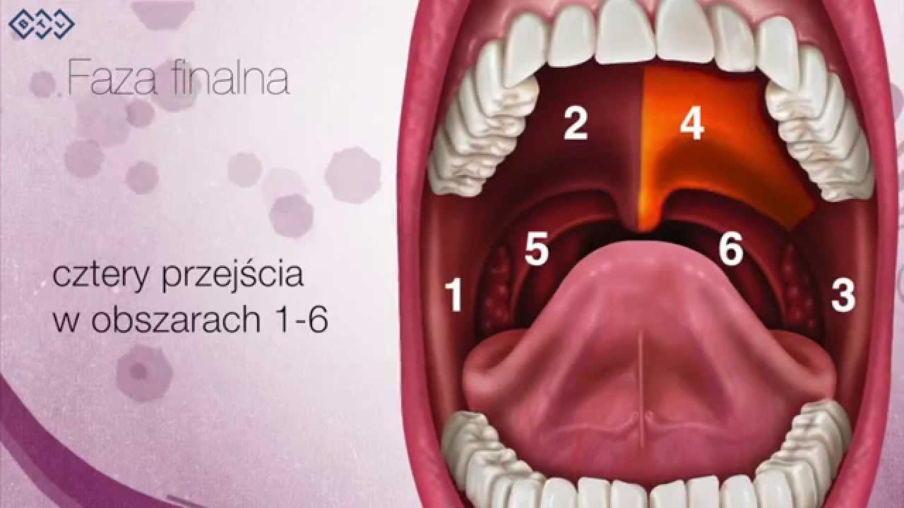Laserowe leczenie chrapania metodą NightLase FOTNA