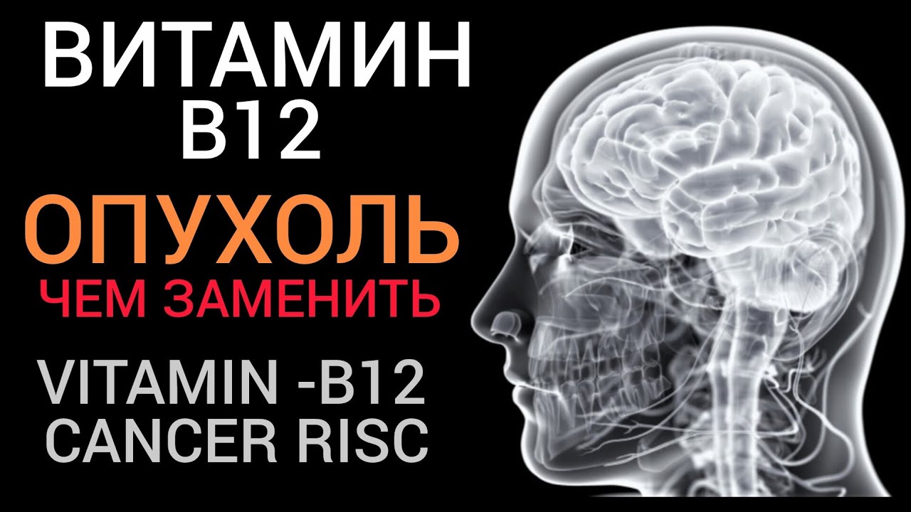 ВИТАМИН В12 l ОНКОЛОГИЯ l Чем заменить Vitamin B12 - Cancer risc