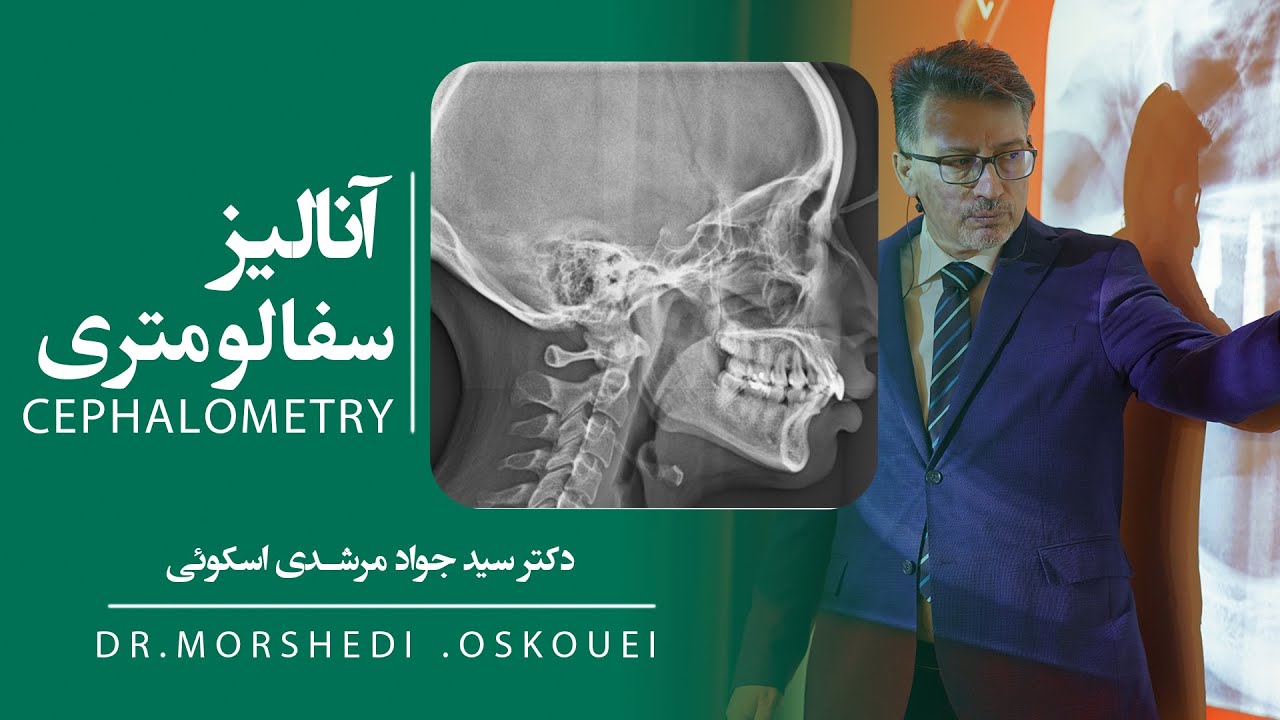 Cephalometry