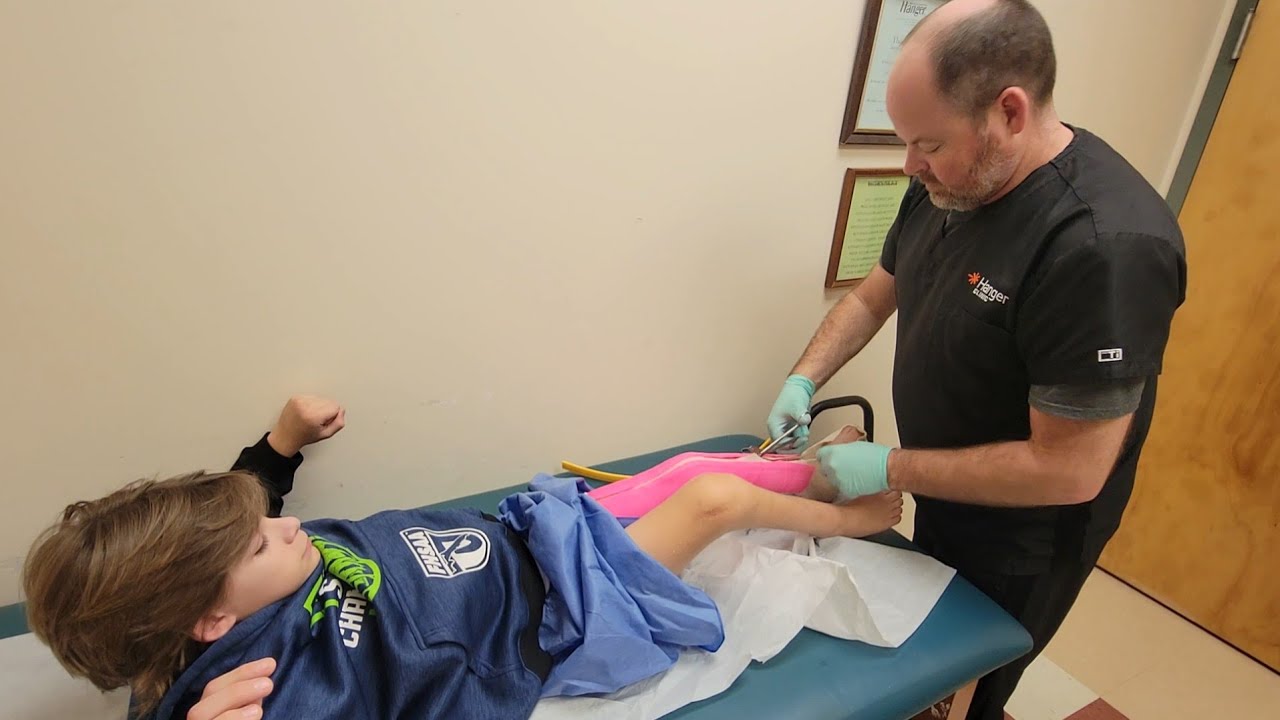 Casting For My 1st Knee Extension  Braces, the fitting, and how I put on my knee and back braces.