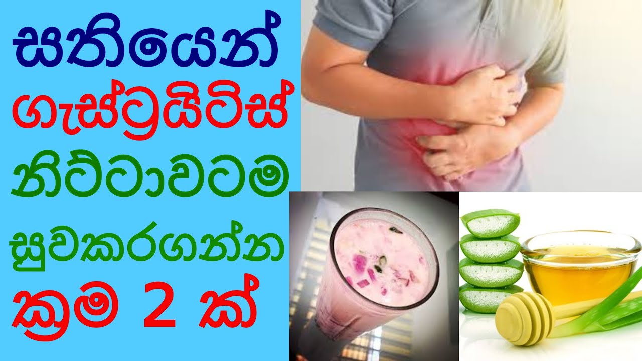 Gastritis ගැස්ට්&zwj;රයිටිස් සුවකරගන්න ප්&zwj;රත්&zwj;යක්ෂ බෙහෙත සිංහල Gastik walata beheth - Sonduru Diviya