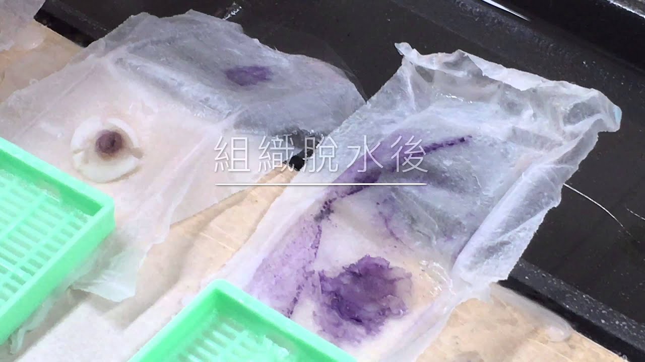 Hitstogel 技術-台北榮總細胞