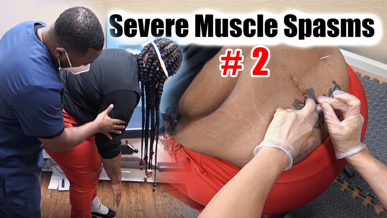 SEVERE MUSCLE SPASMS #2. Back pain with movements.