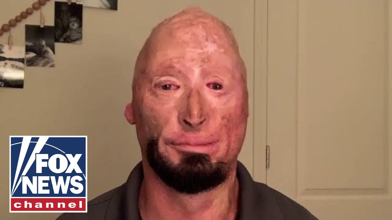Wounded veteran tells Democrats to stop using him as a prop