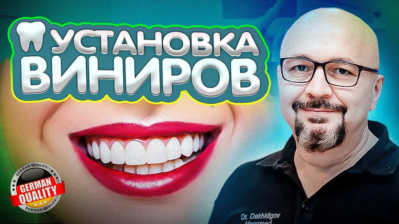 Установка виниров на зубы в ТОП 1 клинике Москвы. Немецкий имплантологический центр.