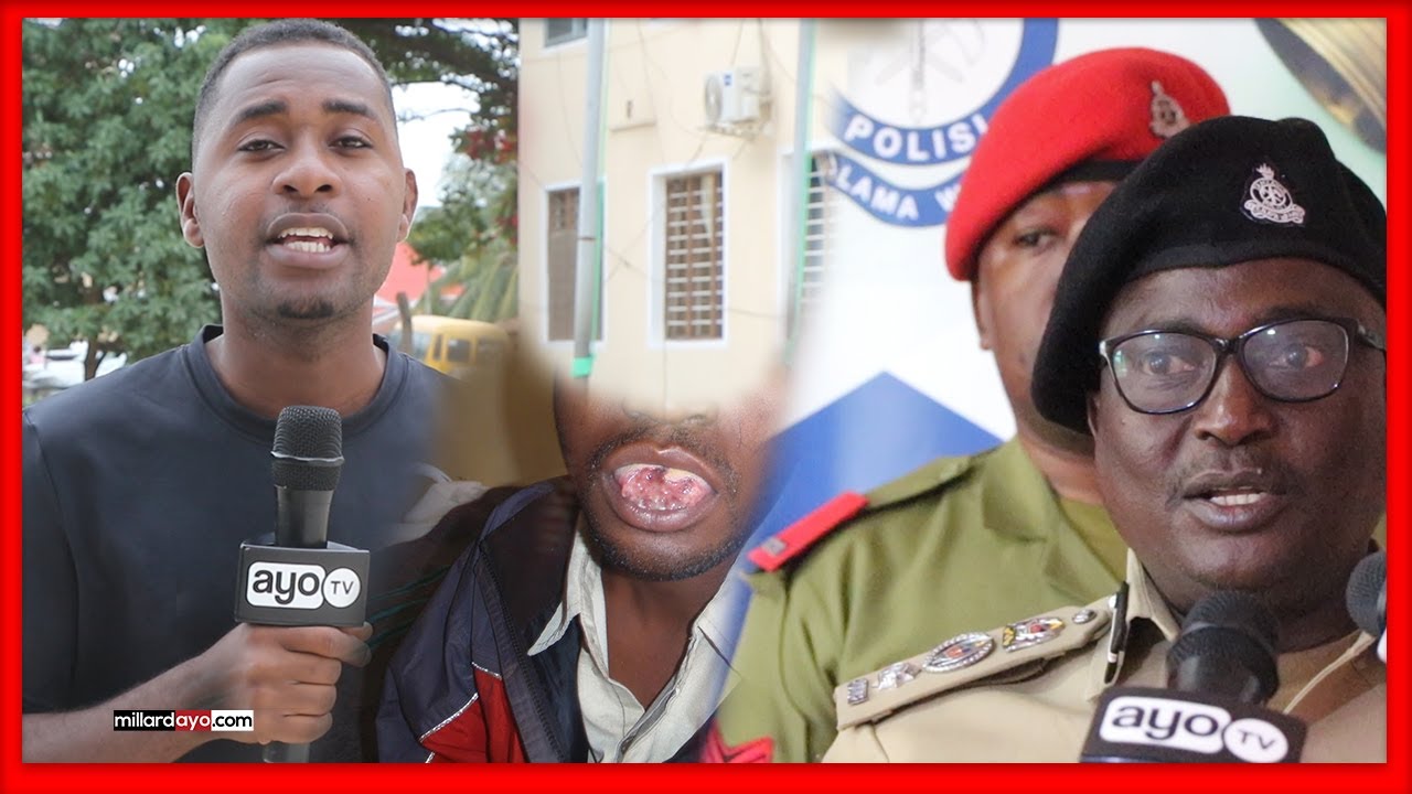 MWANAMKE AMKATA ULIMI MPENZI WAKE ,ZANZIBAR APEWA BUSU, MKASA HUU HAPA