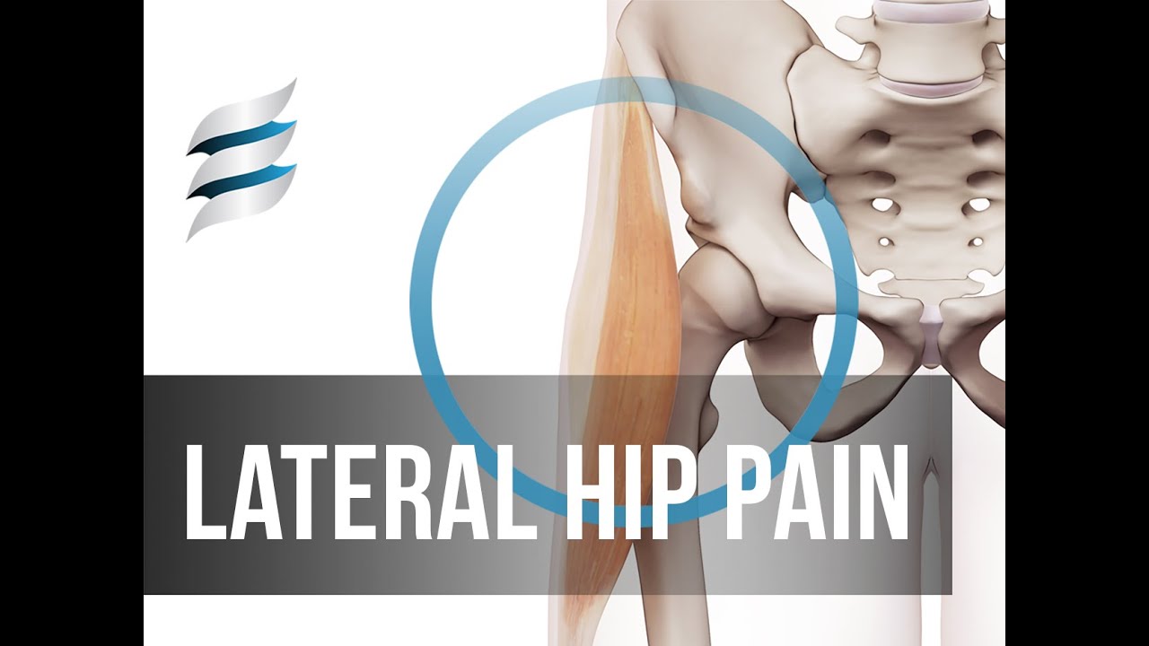 Lateral Hip Pain - Trochanteric bursitis & Hip abduction - The connection
