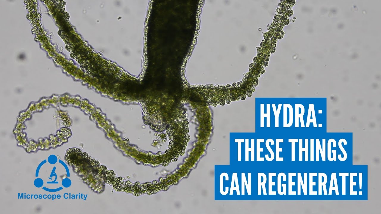 Hydra under a microscope (regenerative microorganisms!)