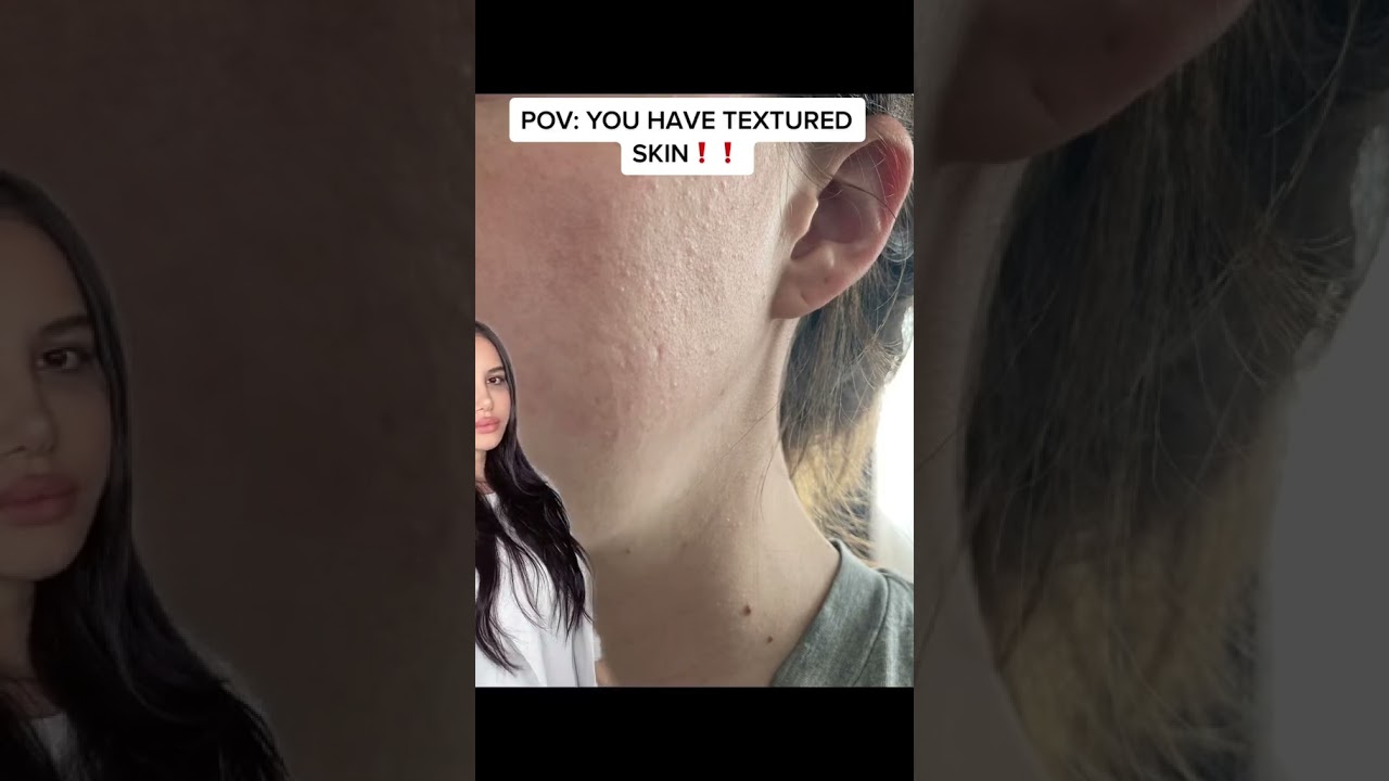 Do you have TEXTURED SKIN?!