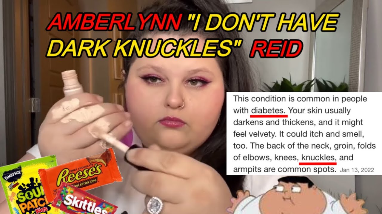 Amberlynn Reid Denying Diabetes Accusations