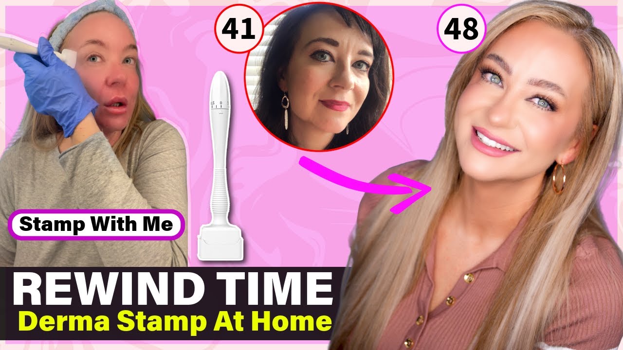 TRY Collagen Banking at Home with Me: My At-Home Derma Stamp Transformation🖊️ 🧐