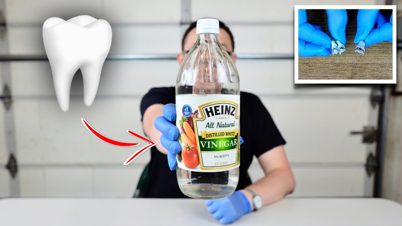 I Left a Tooth in Vinegar for 7 Days (Experiment)