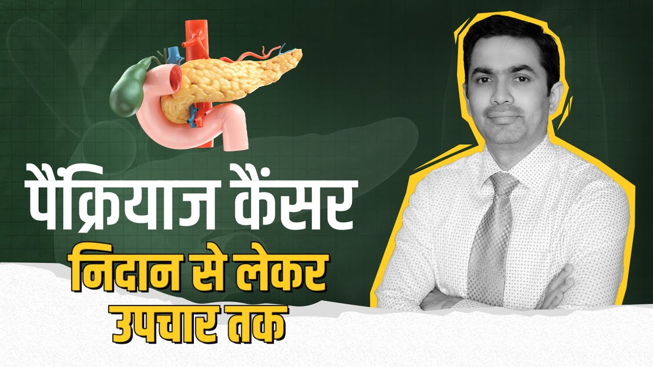 पैंक्रियाज कैंसर क्या है और क्यों होता है? जाने लक्षण, निदान, स्टेजिंग और इलाज | Pancreatic Cancer