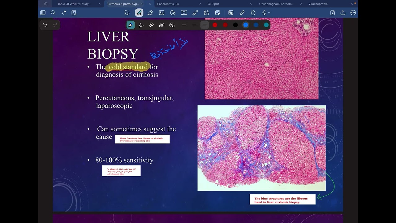 Lecture 37 - Cirrhosis and Portal Hypertension - Dr. Sarah