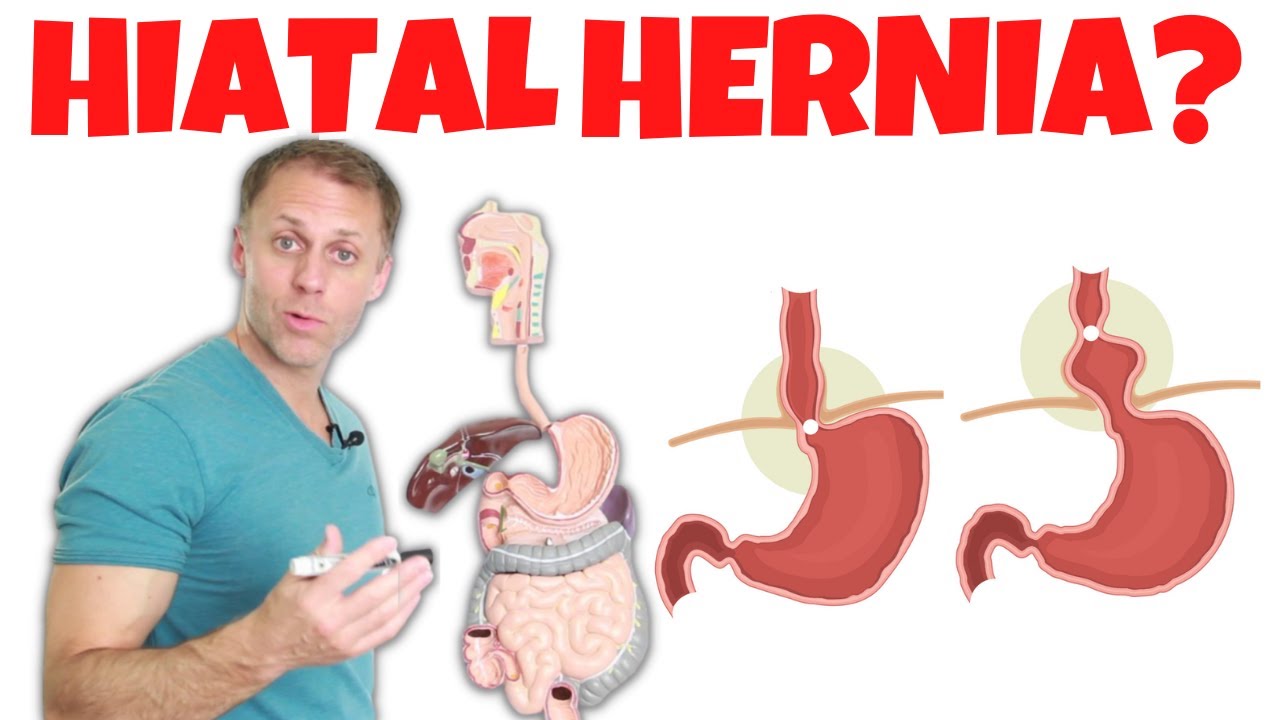 Understanding a Hiatal Hernia