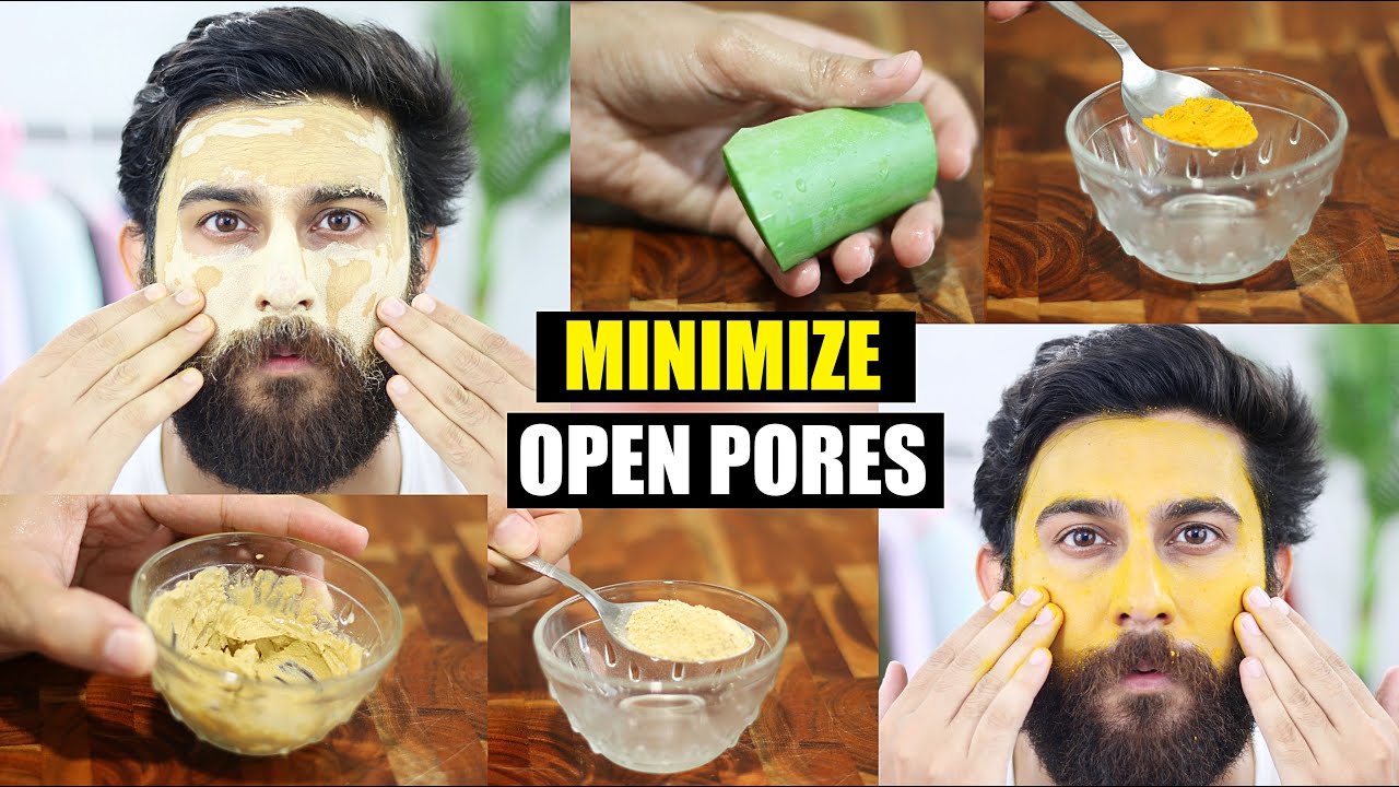 Open Pores | Clogged Pores & Enlarged Pores | Home Remedies