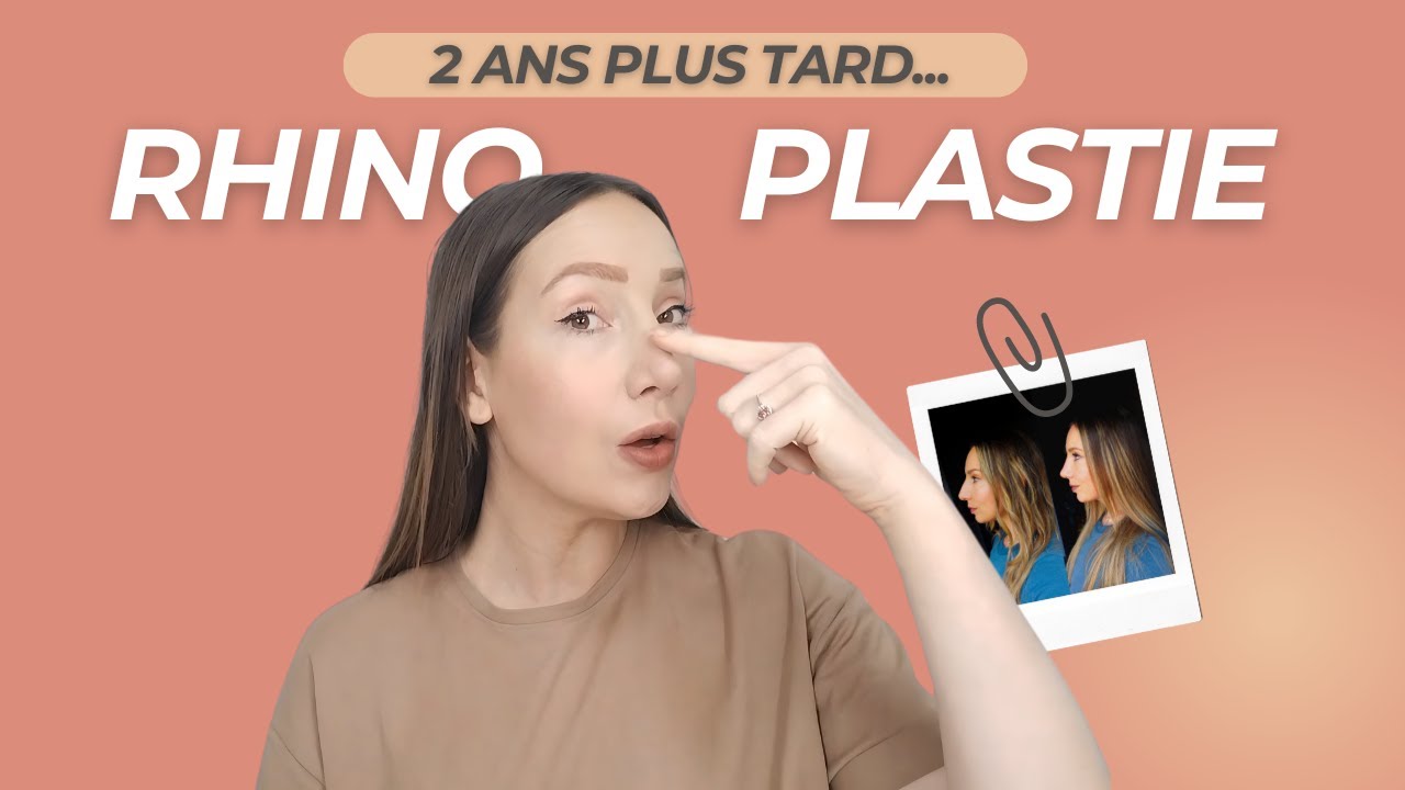 RHINOPLASTIE : Post op, bilan et conseils 2 ans plus tard