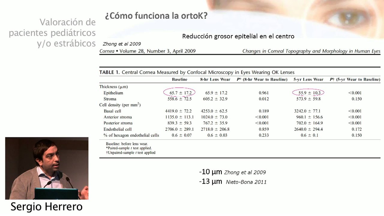 Ortoqueratología en población joven