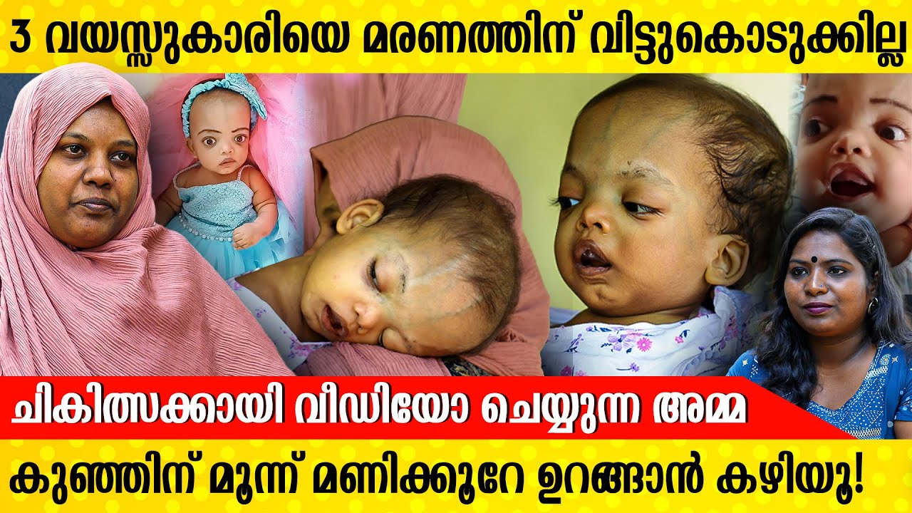 3 വയസുകാരിയുടെ ചികിത്സാ ചിലവിനായി വീഡിയോ ചെയ്യുന്ന ഒരമ്മ ; ഉറങ്ങാത്ത ആയിഷുട്ടി| OSTEOPETROSIS