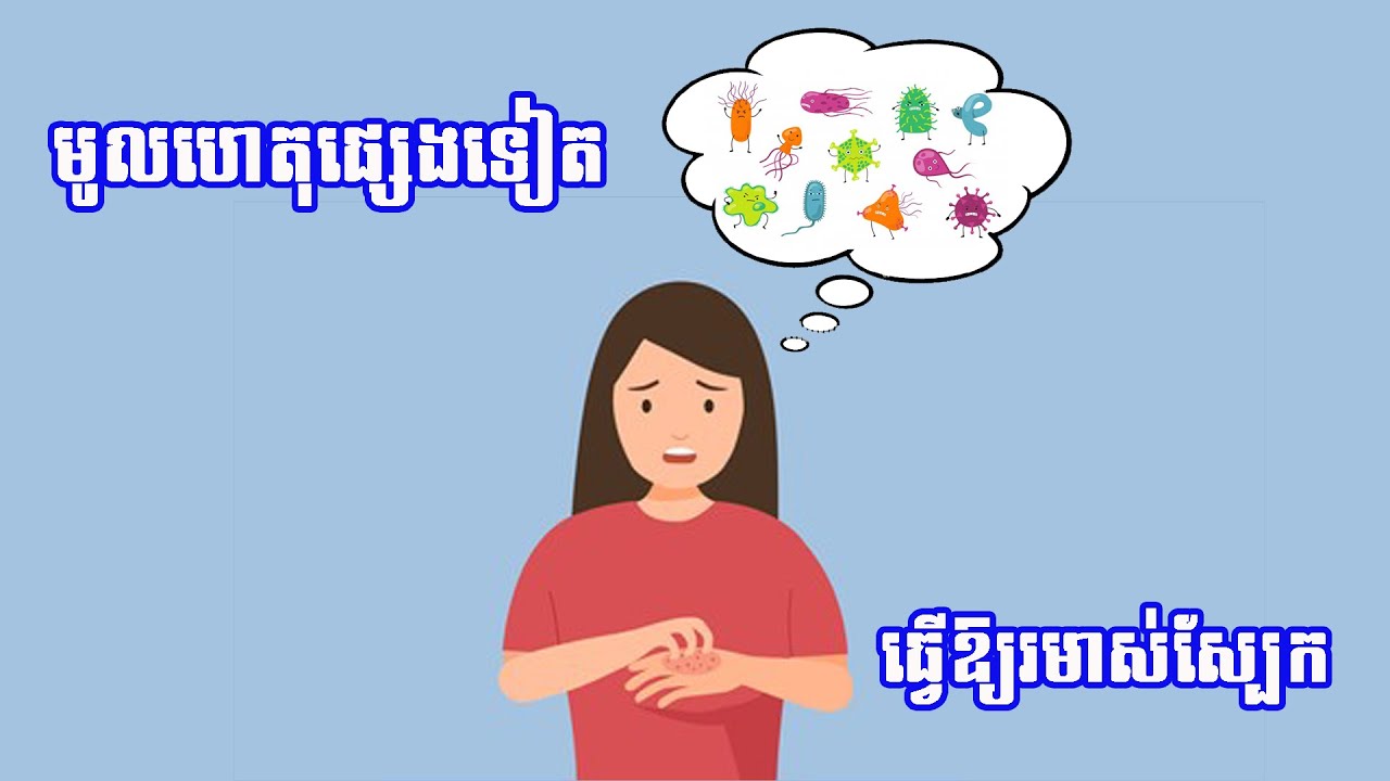 មូលហេតុផ្សេងៗធ្វើឱ្យរមាស់ស្បែក