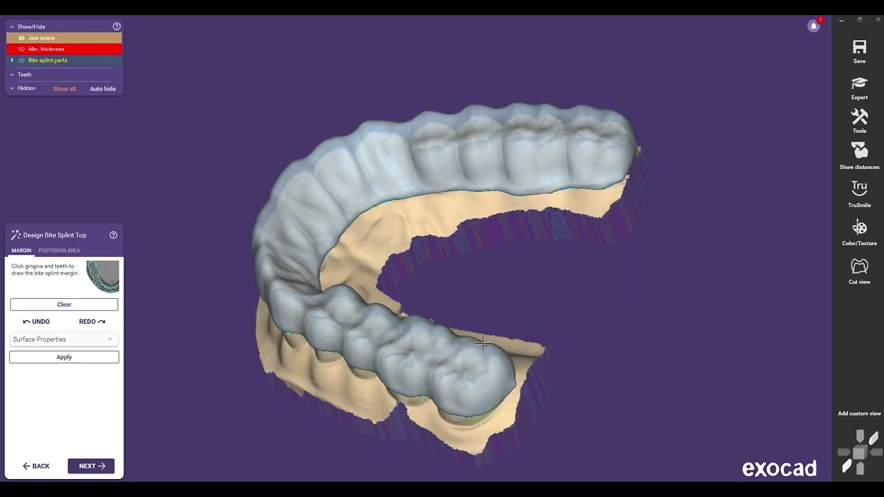 How to design a Bite Splint in exocad