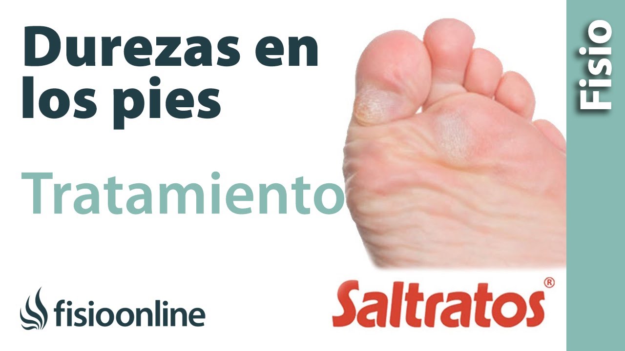 Callos y durezas en los pies. Causas, consejos y tratamiento