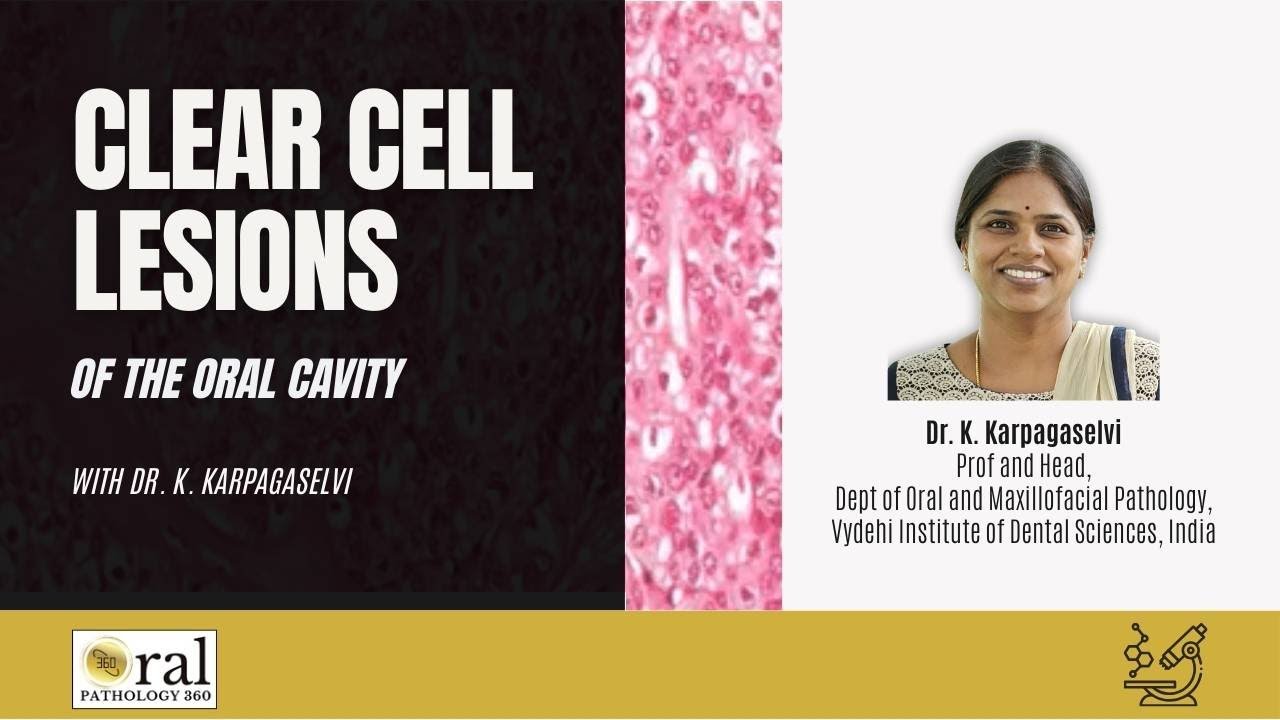 Clear Cell Lesions of Oral Cavity| Oral pathology 360| Updates