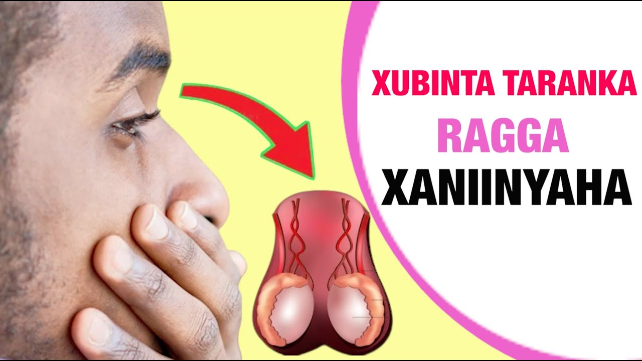 XANIINYAHA IYO XUBINTA TARANKA RAGA CALAMADAHA HALISTA AH.