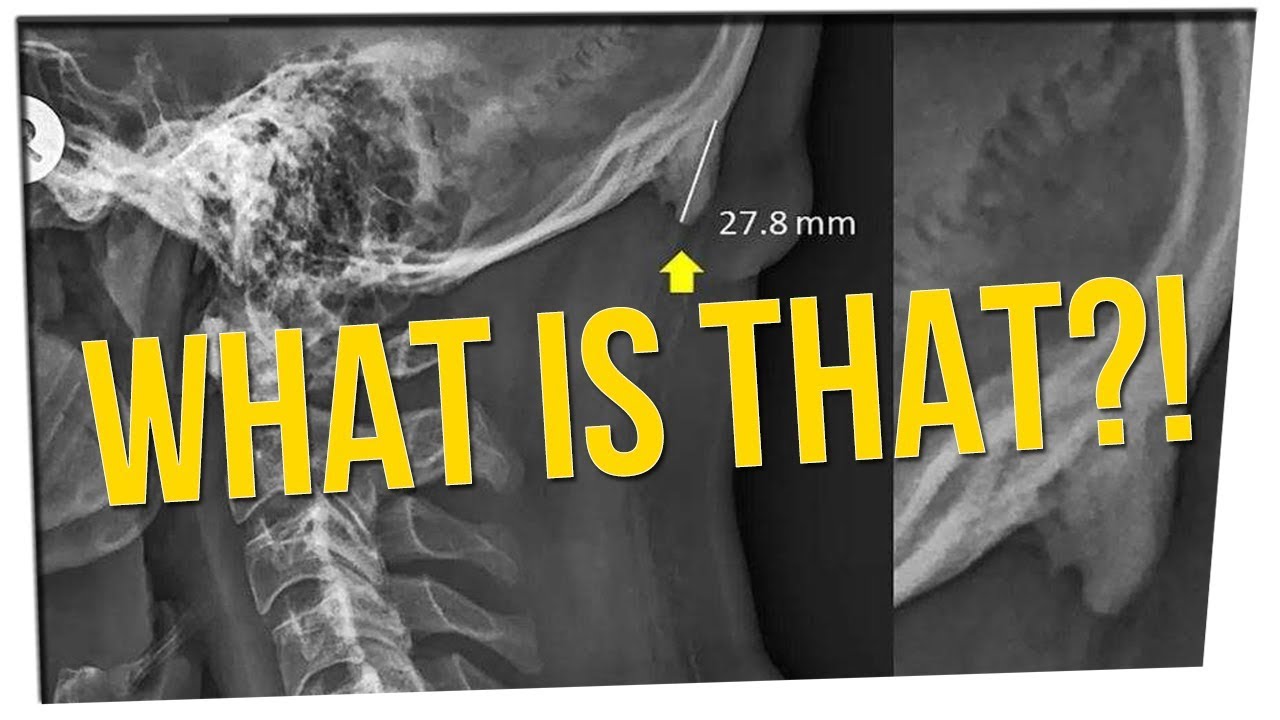 People Are Growing Cell Phone Bones?! (ft. Erik Griffin)