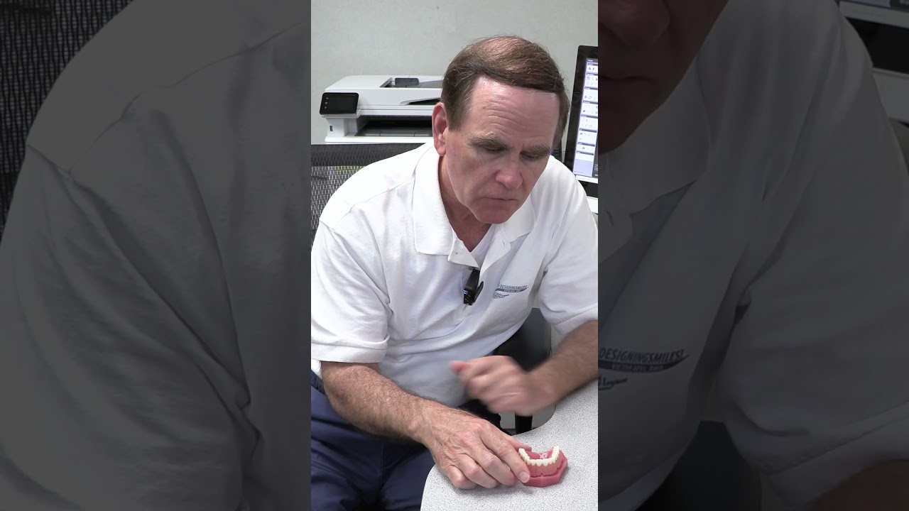 What is a Snap-On Denture? | Mini Dental Implants in Melbourne, FL | Designing Smiles #shorts