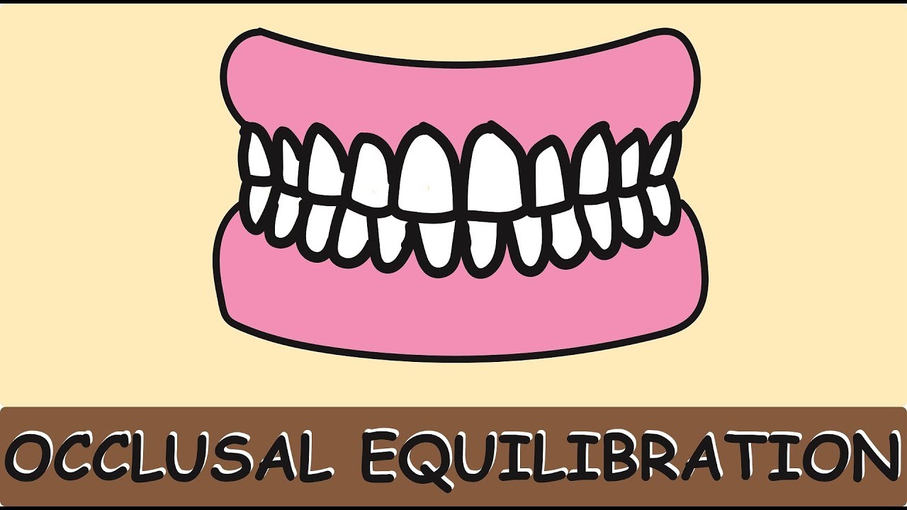 Occlusal Equilibration