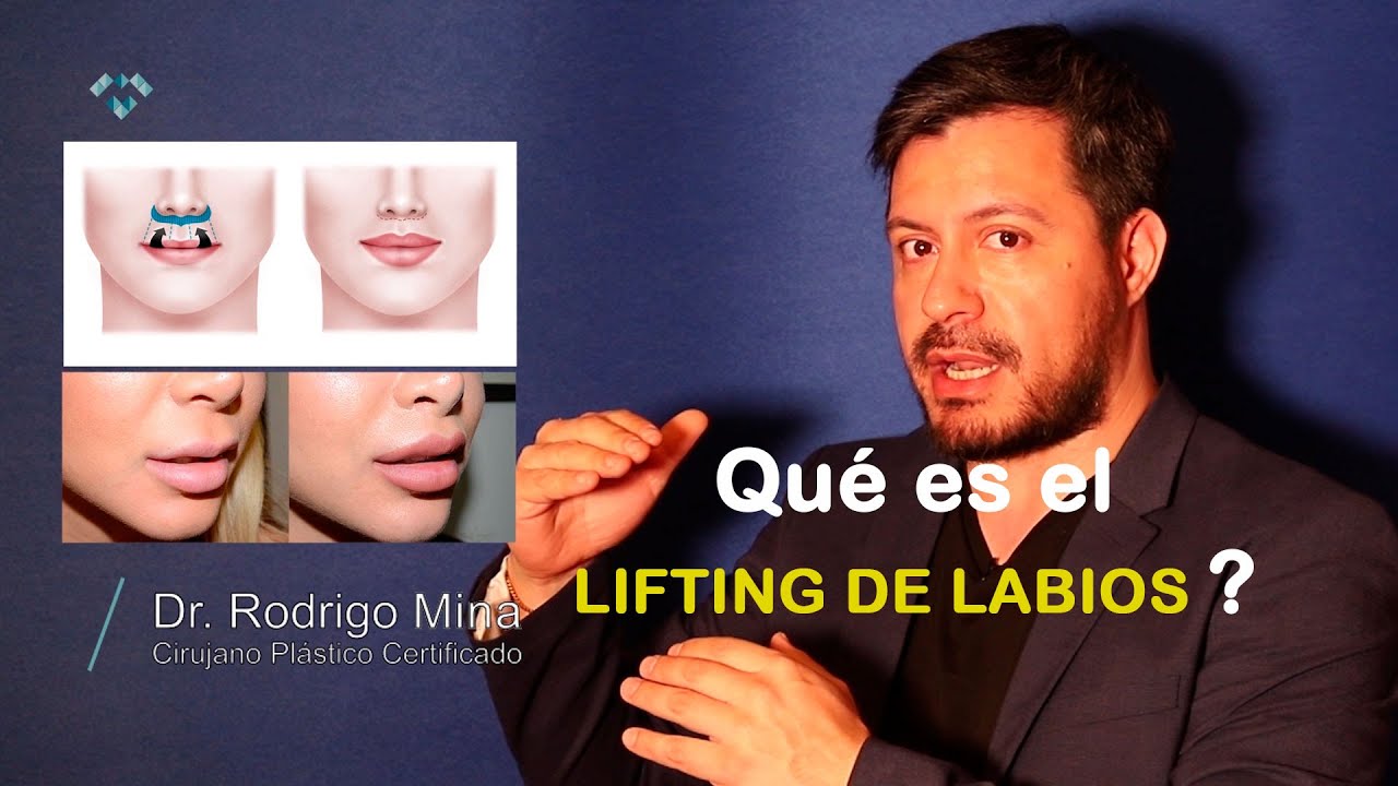 Conoc&iacute;as el LIFTING de LABIOS? la cirug&iacute;a que EMBELLECE los labios