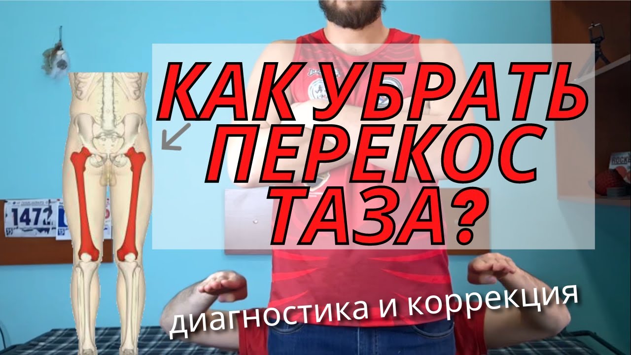 Перекос таза. Как выровнять таз через мышцы. Кинезиология. Часть 1