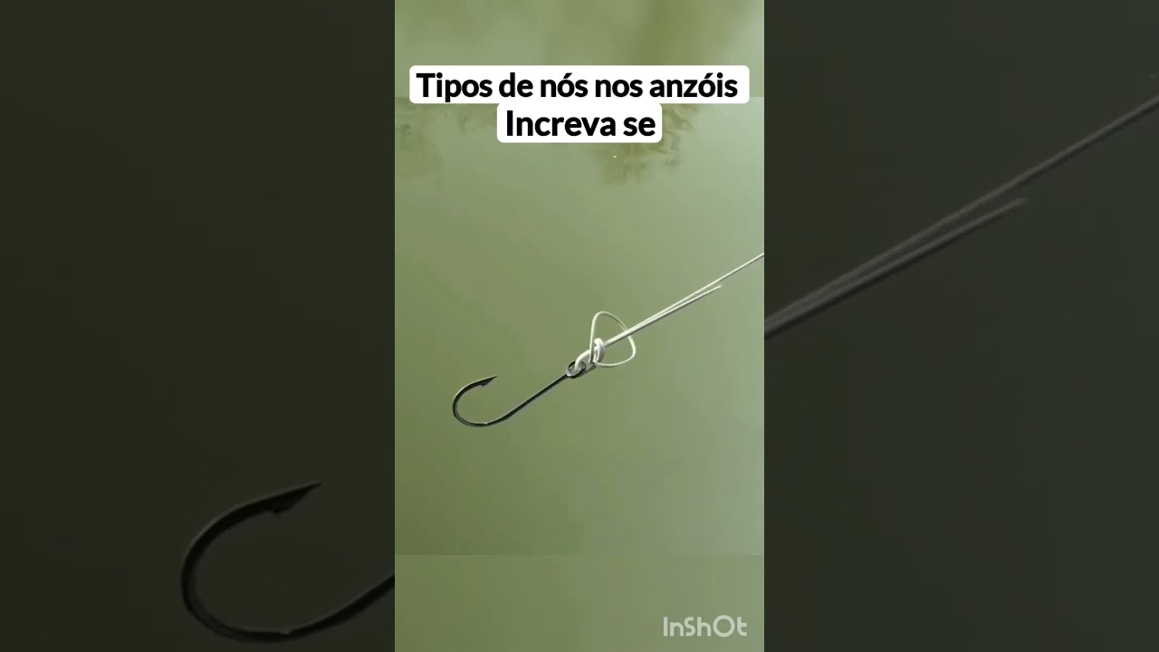 tipos de n&oacute;s nos #anz&oacute;is