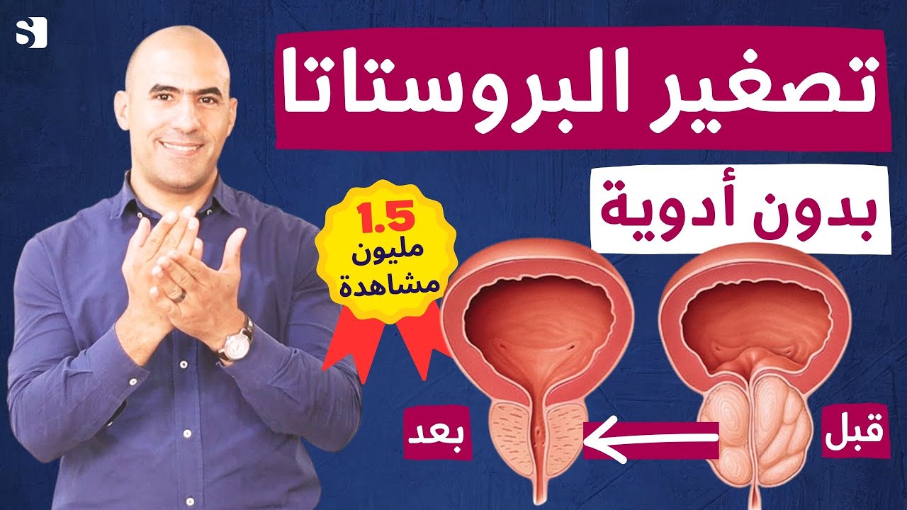 كيفية علاج تضخم البروستاتا وتكرار التبول بأفضل الأعشاب والأطعمة | اهم فيتامين يعيد البروستات للشباب