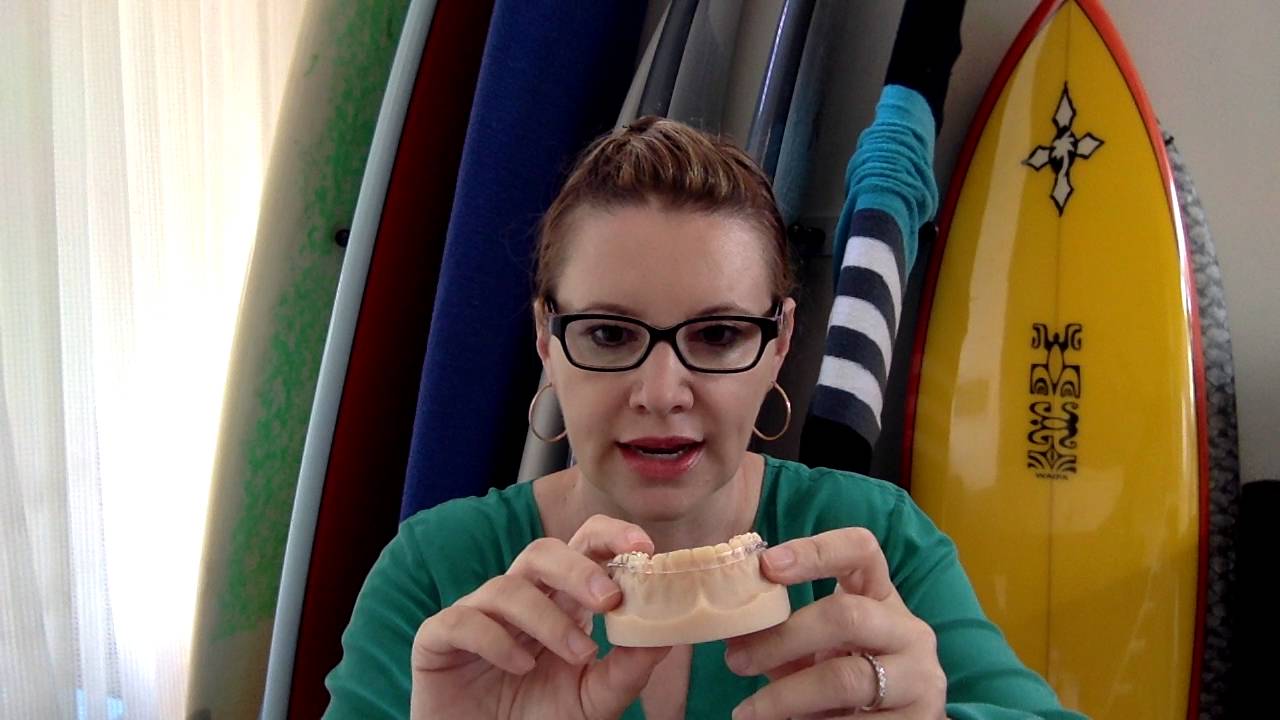 Inman Aligner® Unboxing!