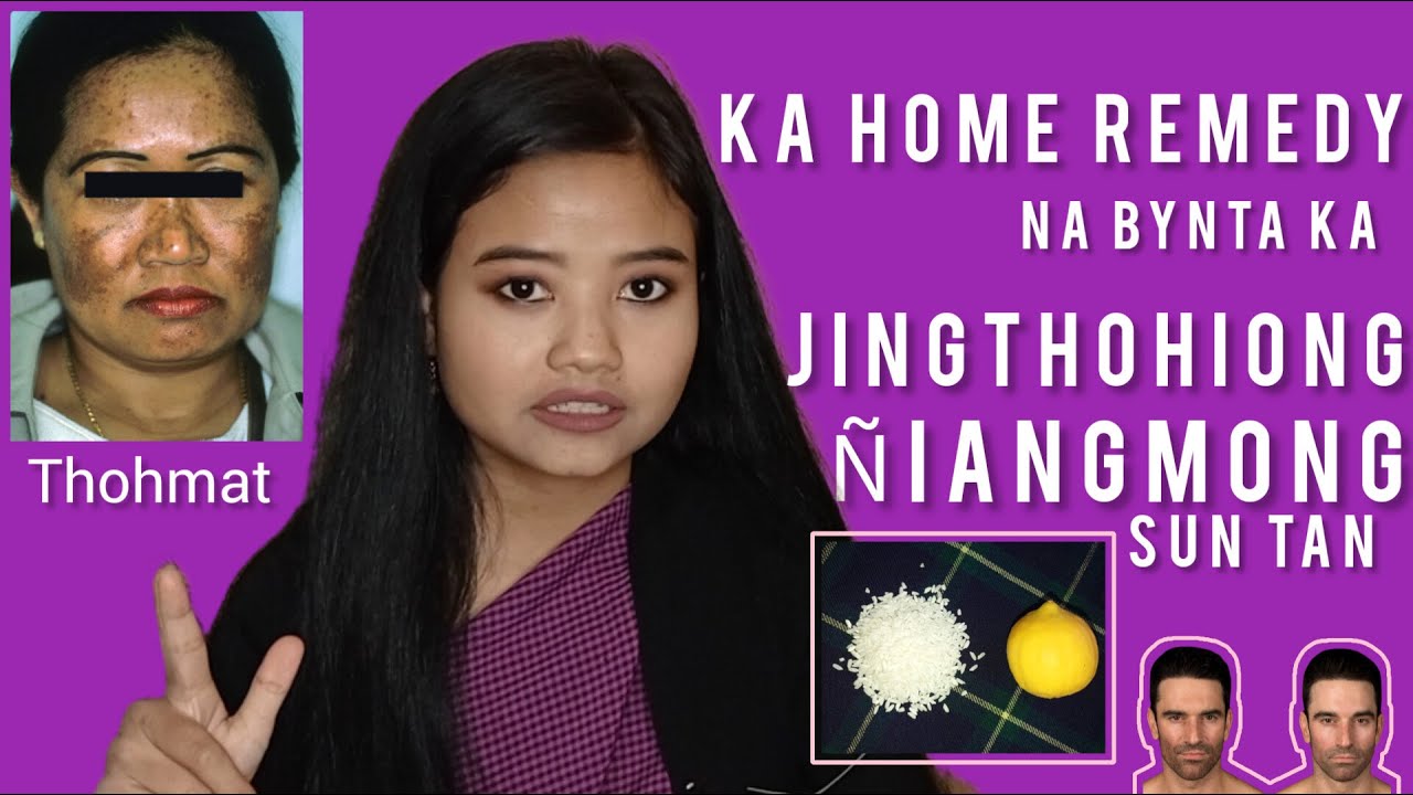 Ka Jingthohiong, &Ntilde;iangmong & kiwei2 | Ka Homemade Remedy ba iarap bha | 100%