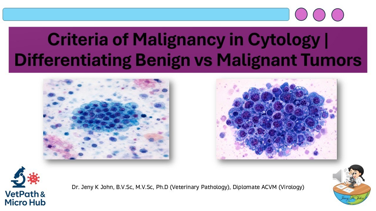 Criteria of Malignancy in Cytology | Differentiating Benign vs Malignant Tumors